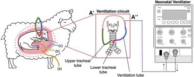 Mechanical ventilation induces brainstem inflammation in preterm fetal sheep